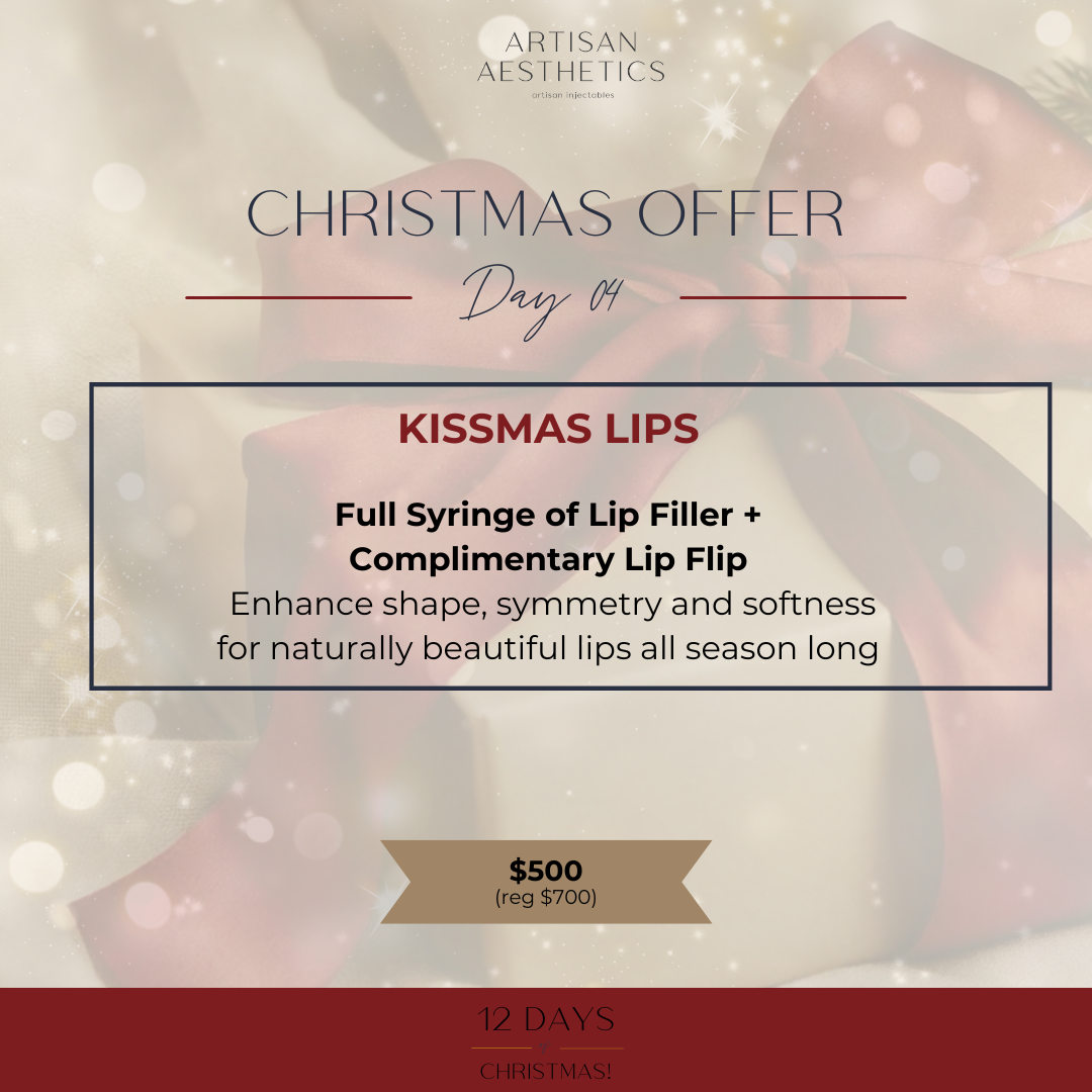Kissmas Lips